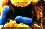 Il Thiobacillus ferrooxidans  un archibatterio che utilizza il ferro come fonte di energia